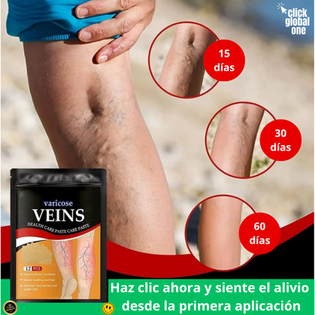 Parches para várices (3 sobres con 12 parches c/u)