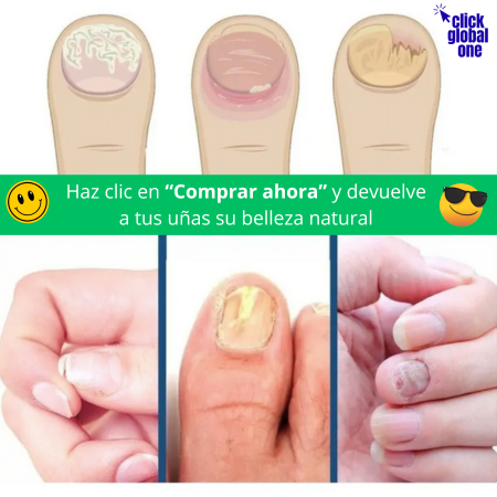 Parche hongo de pies (2 sobres con 16 parches c/u)